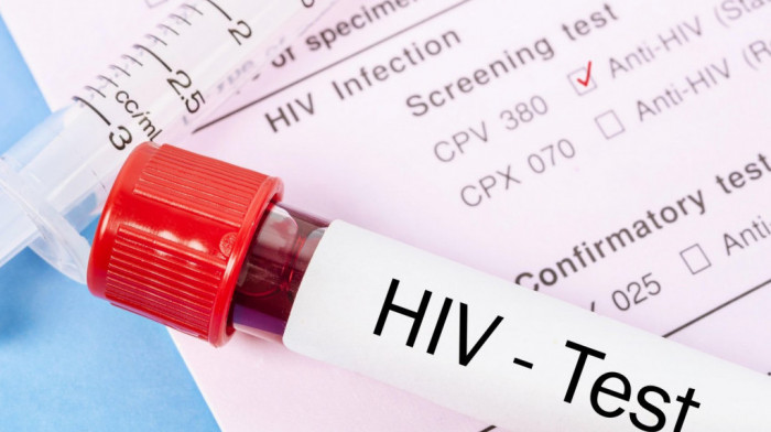 Naučnici razvili metodu za uništavanje virusa HIV u laboratorijskim uslovima